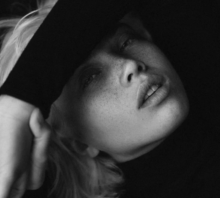 skin-rejuvenation-microneedling