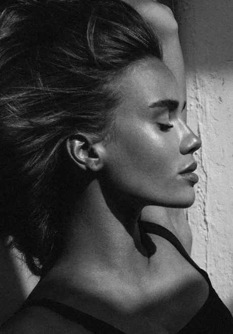 skin-rejuvenation-morpheus8