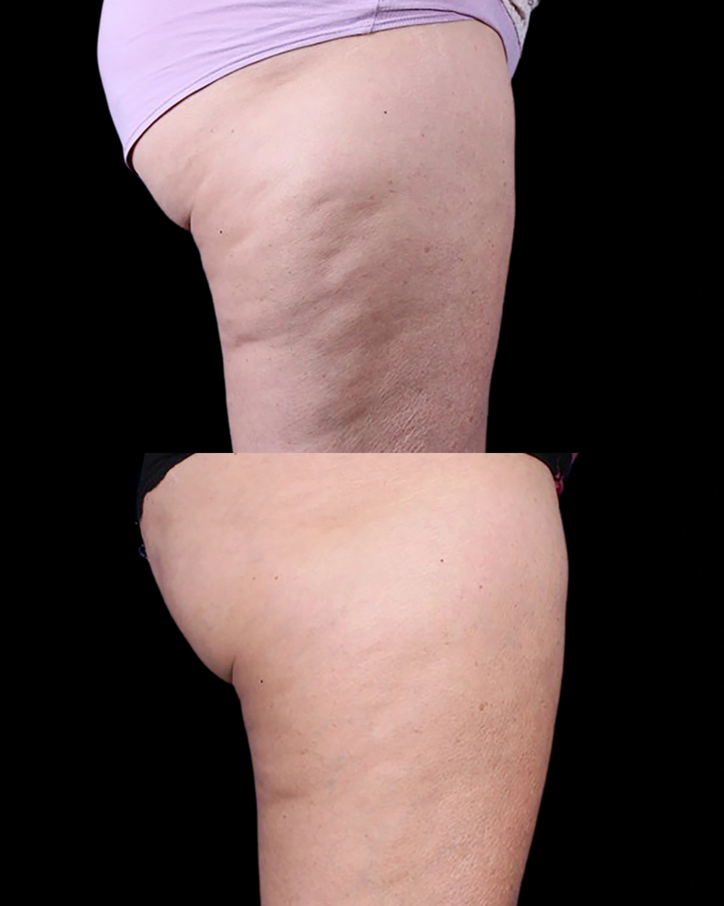 Real Patient Results by Motykie Med Spa serving Beverly Hills & Los Angeles, CA