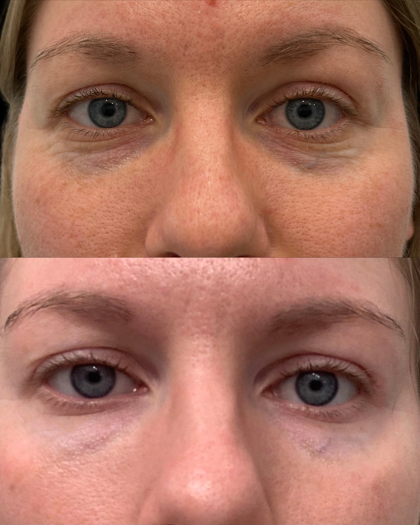 Real Patient Results by Motykie Med Spa serving Beverly Hills & Los Angeles, CA