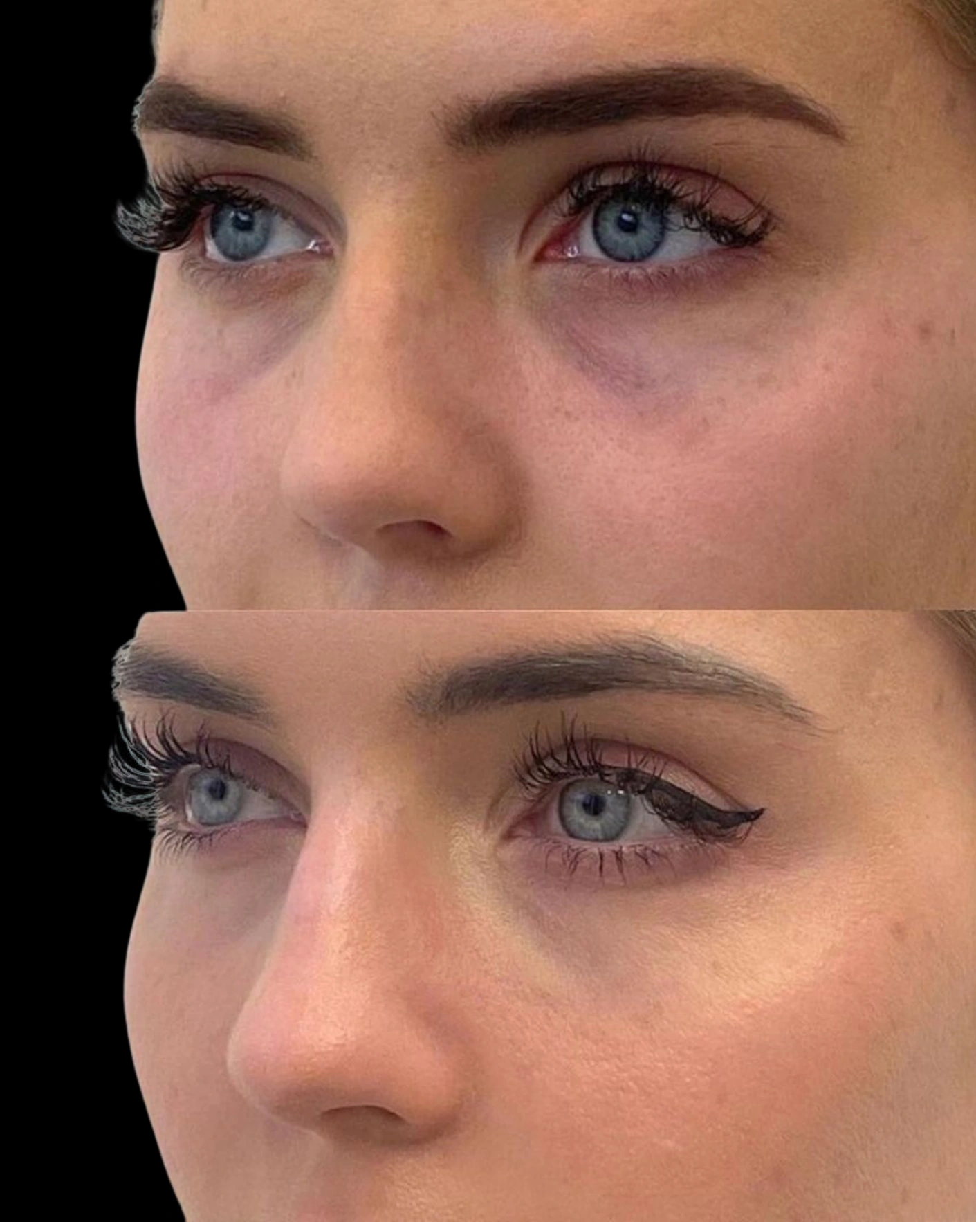 Real Patient Results by Motykie Med Spa serving Beverly Hills & Los Angeles, CA