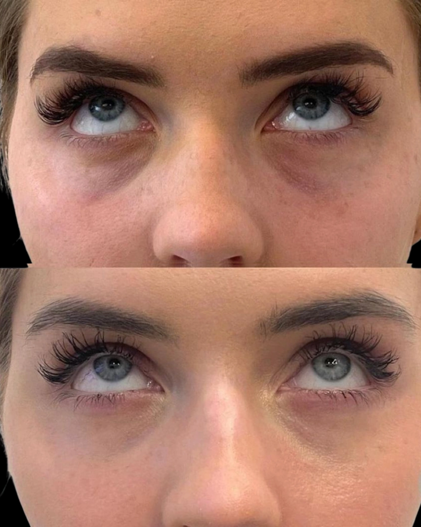 Real Patient Results by Motykie Med Spa serving Beverly Hills & Los Angeles, CA