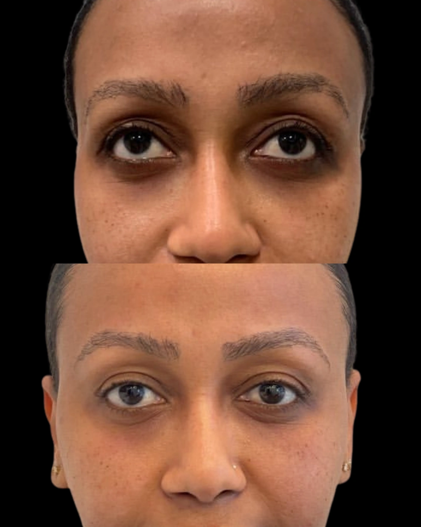 Real Patient Results by Motykie Med Spa serving Beverly Hills & Los Angeles, CA