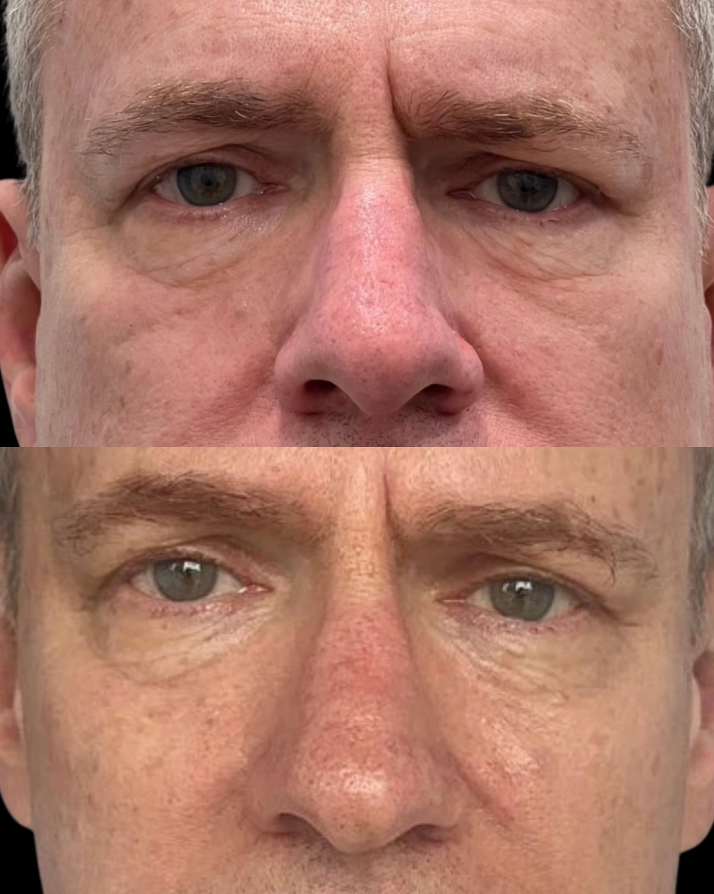 Real Patient Results by Motykie Med Spa serving Beverly Hills & Los Angeles, CA