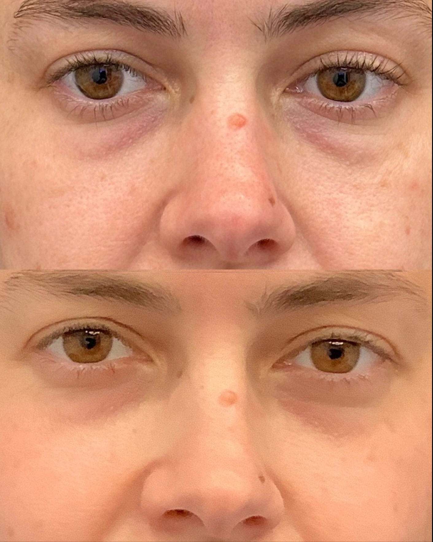 Real Patient Results by Motykie Med Spa serving Beverly Hills & Los Angeles, CA