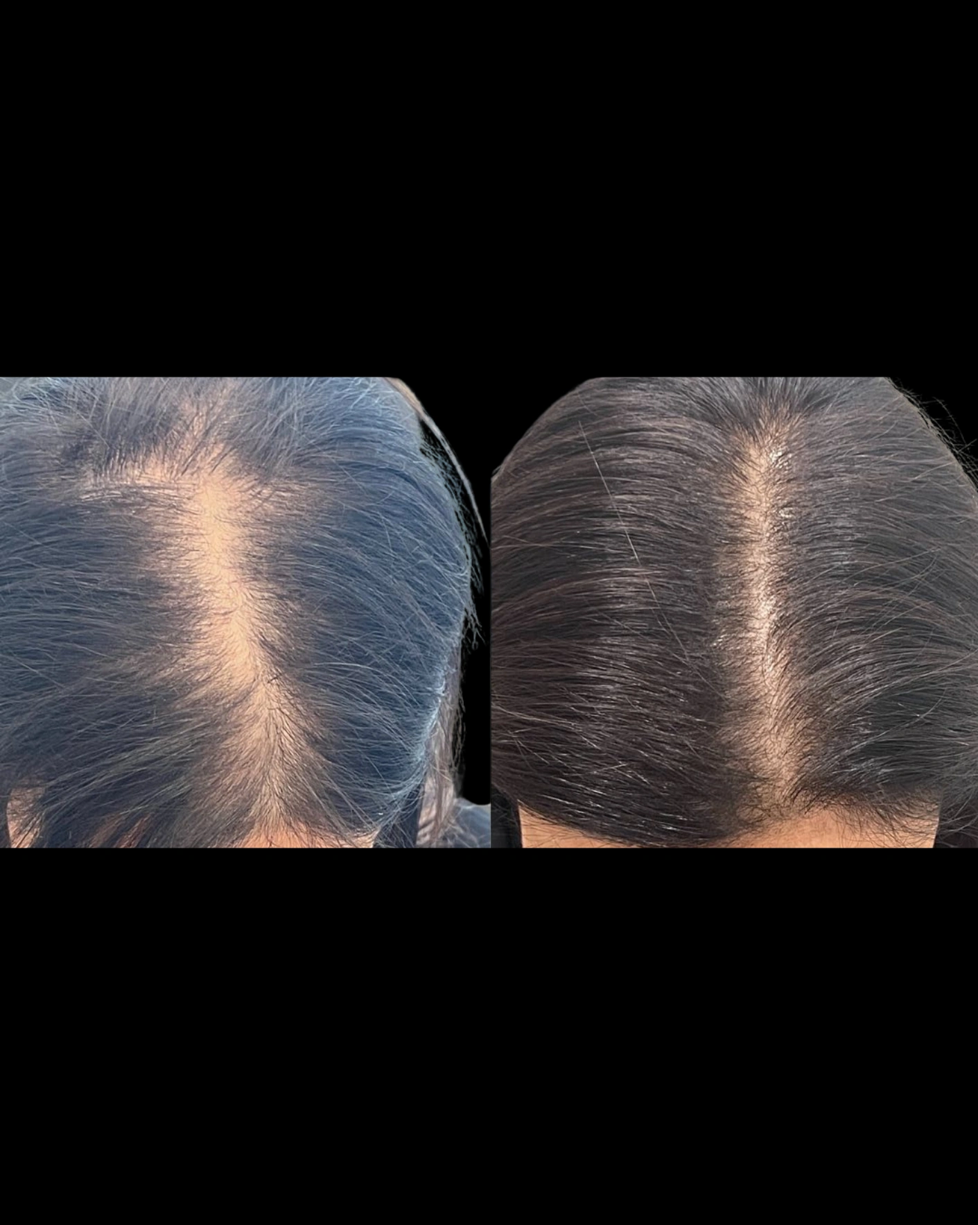 Real Patient Results by Motykie Med Spa serving Beverly Hills & Los Angeles, CA