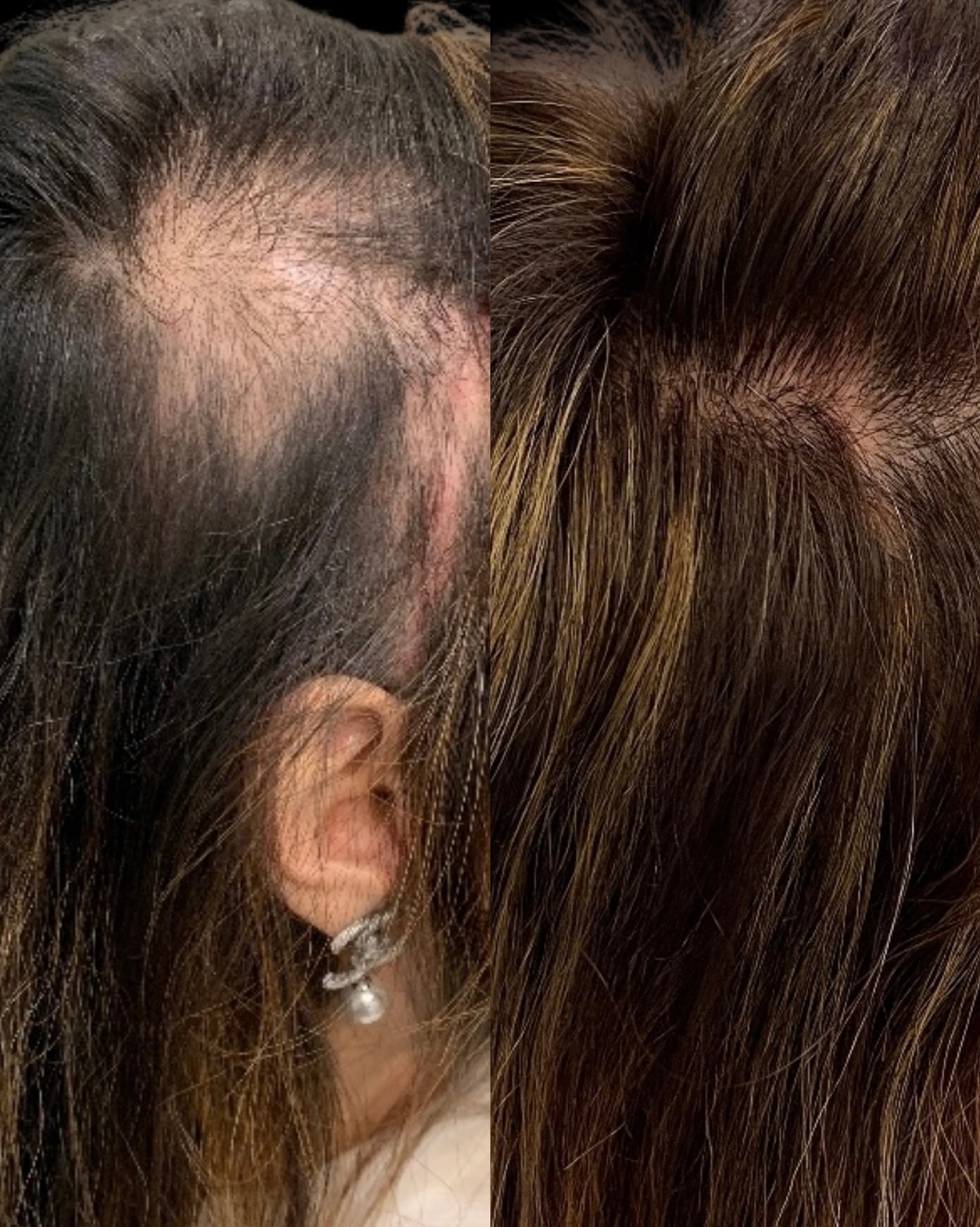 Real Patient Results by Motykie Med Spa serving Beverly Hills & Los Angeles, CA