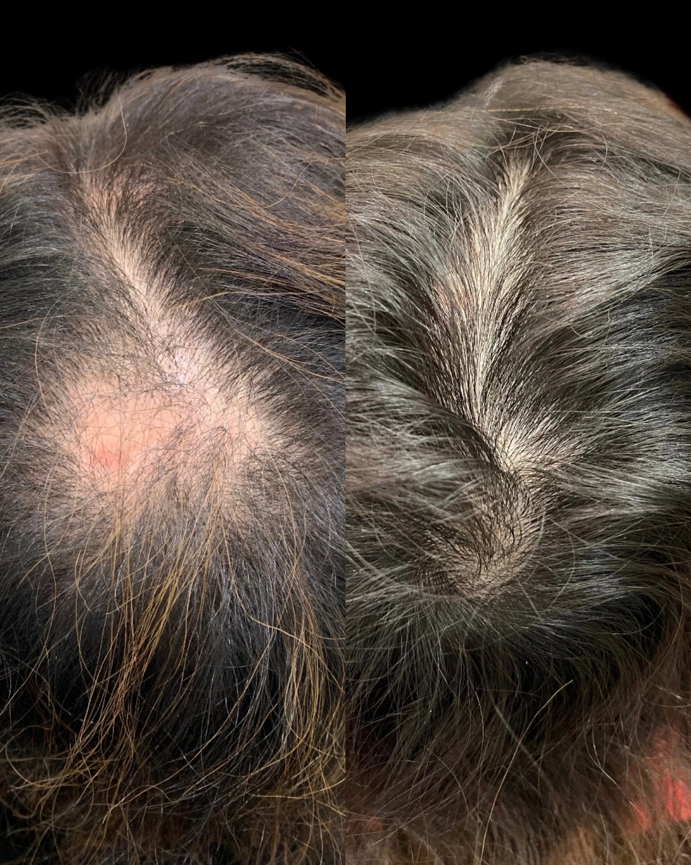 Real Patient Results by Motykie Med Spa serving Beverly Hills & Los Angeles, CA