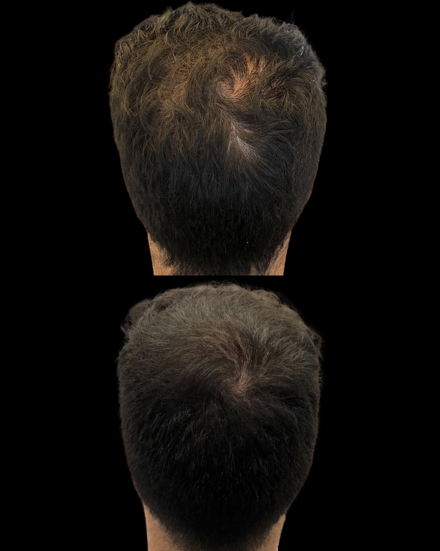 Real Patient Results by Motykie Med Spa serving Beverly Hills & Los Angeles, CA