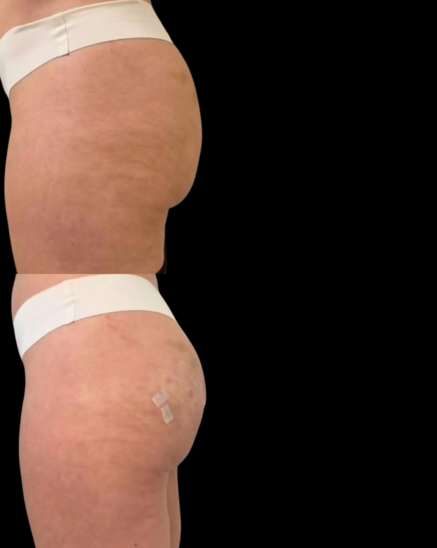 Real Patient Results by Motykie Med Spa serving Beverly Hills & Los Angeles, CA