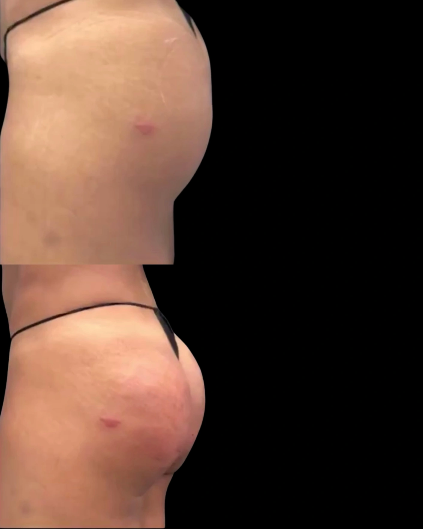 Real Patient Results by Motykie Med Spa serving Beverly Hills & Los Angeles, CA