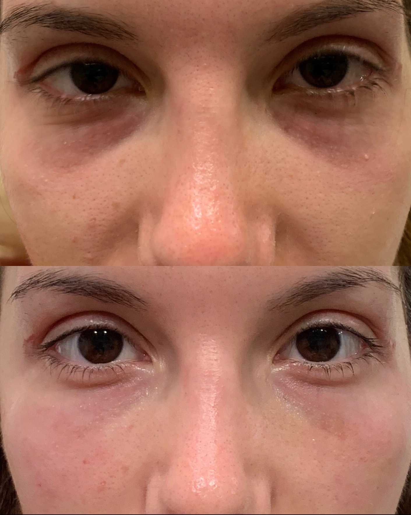 Real Patient Results by Motykie Med Spa serving Beverly Hills & Los Angeles, CA