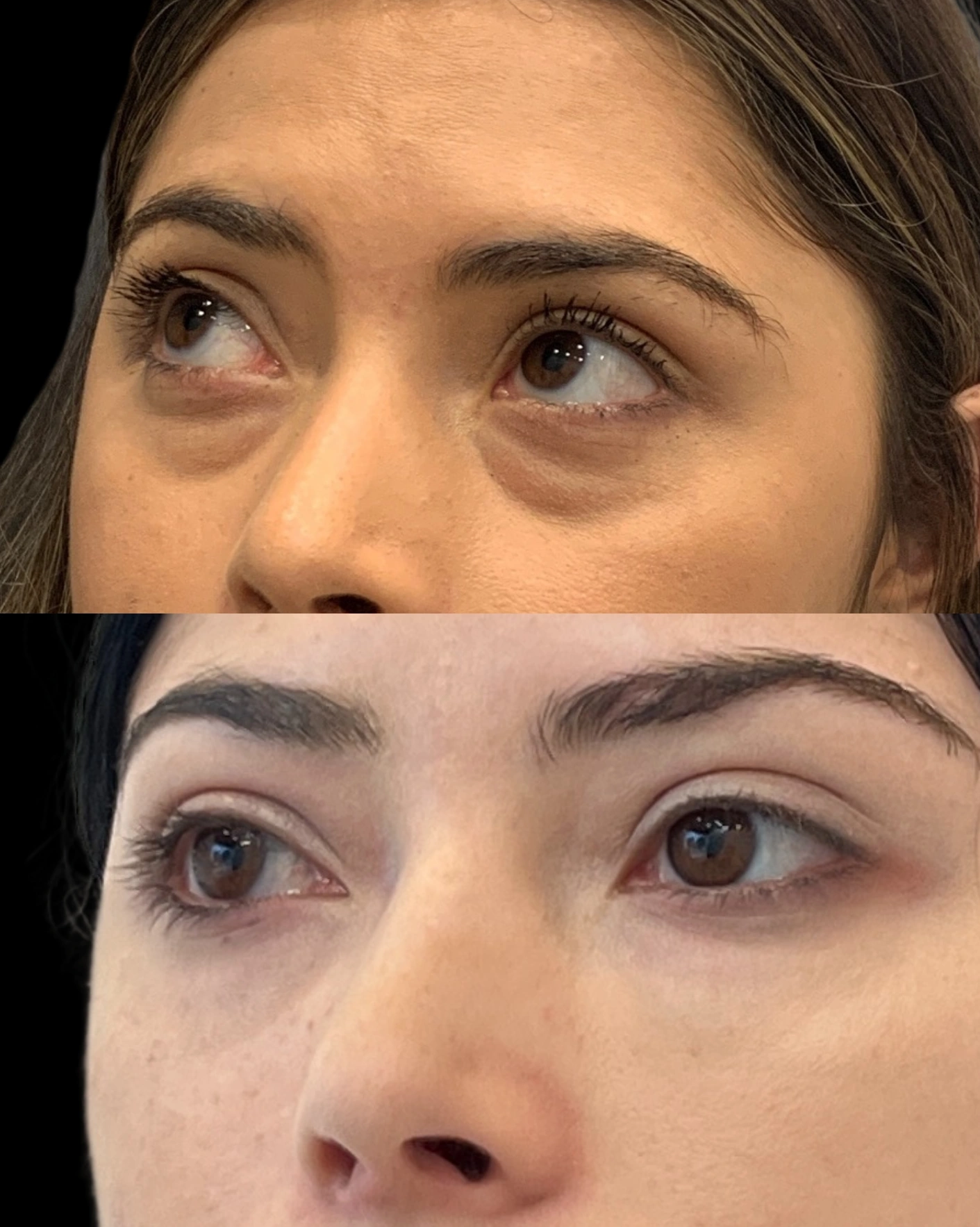 Real Patient Results by Motykie Med Spa serving Beverly Hills & Los Angeles, CA