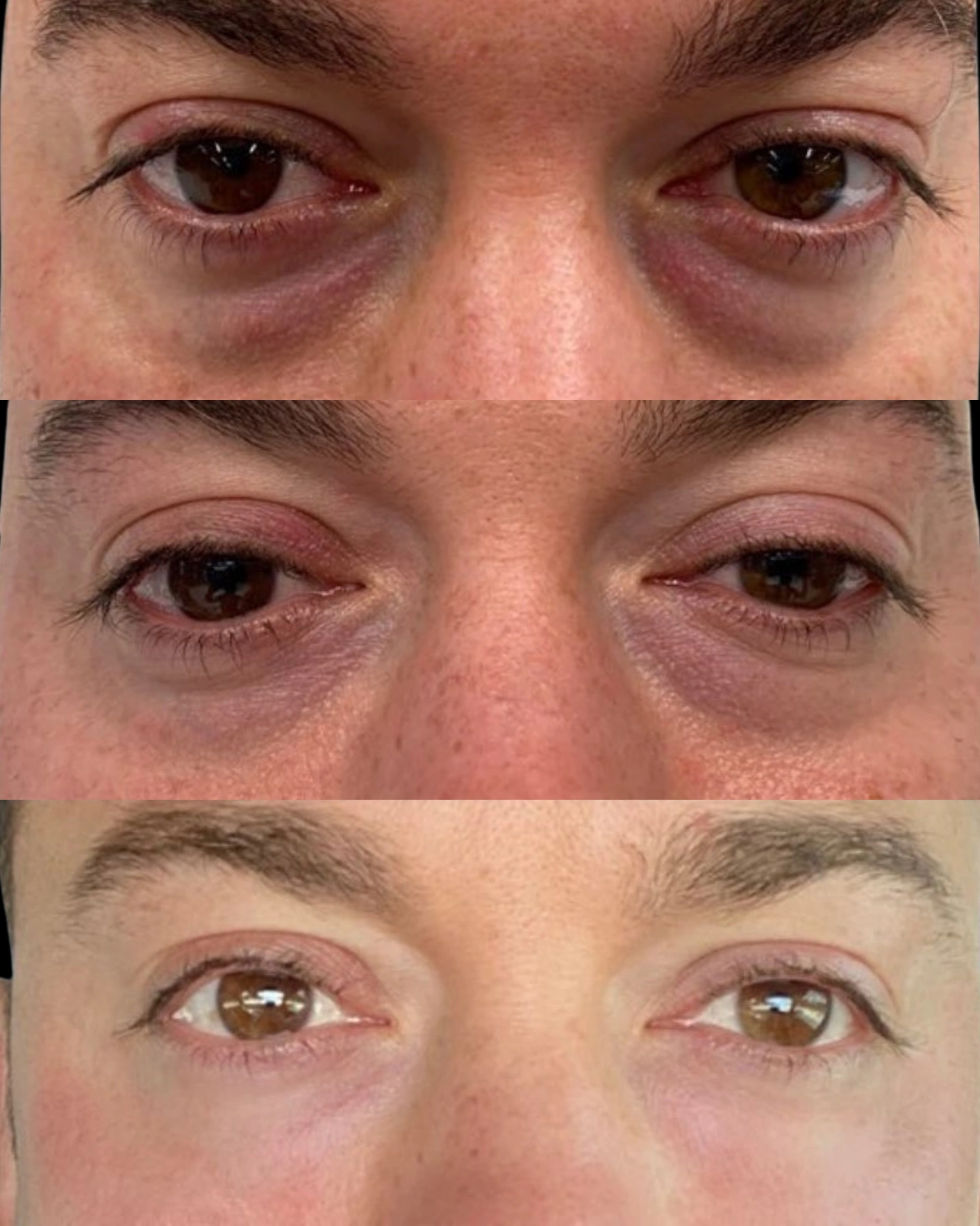 Real Patient Results by Motykie Med Spa serving Beverly Hills & Los Angeles, CA