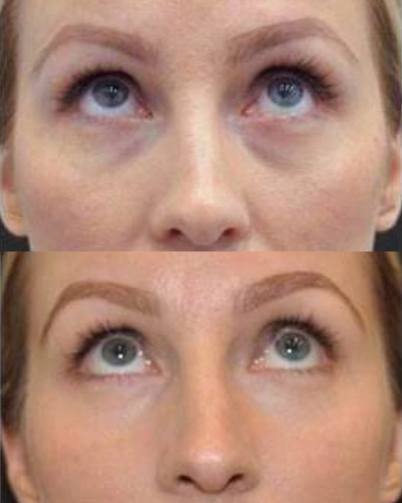 Real Patient Results by Motykie Med Spa serving Beverly Hills & Los Angeles, CA