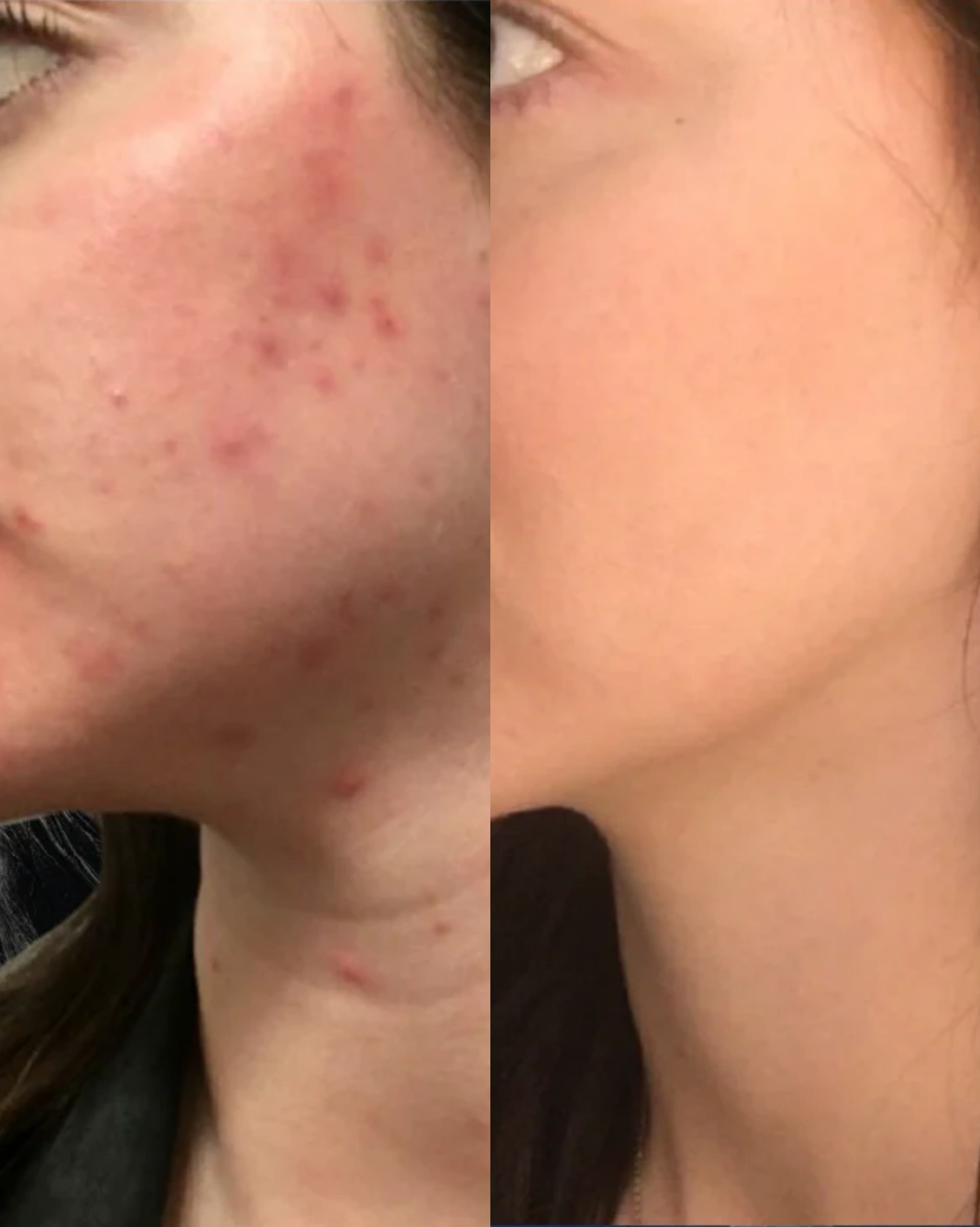 Real Patient Results by Motykie Med Spa serving Beverly Hills & Los Angeles, CA